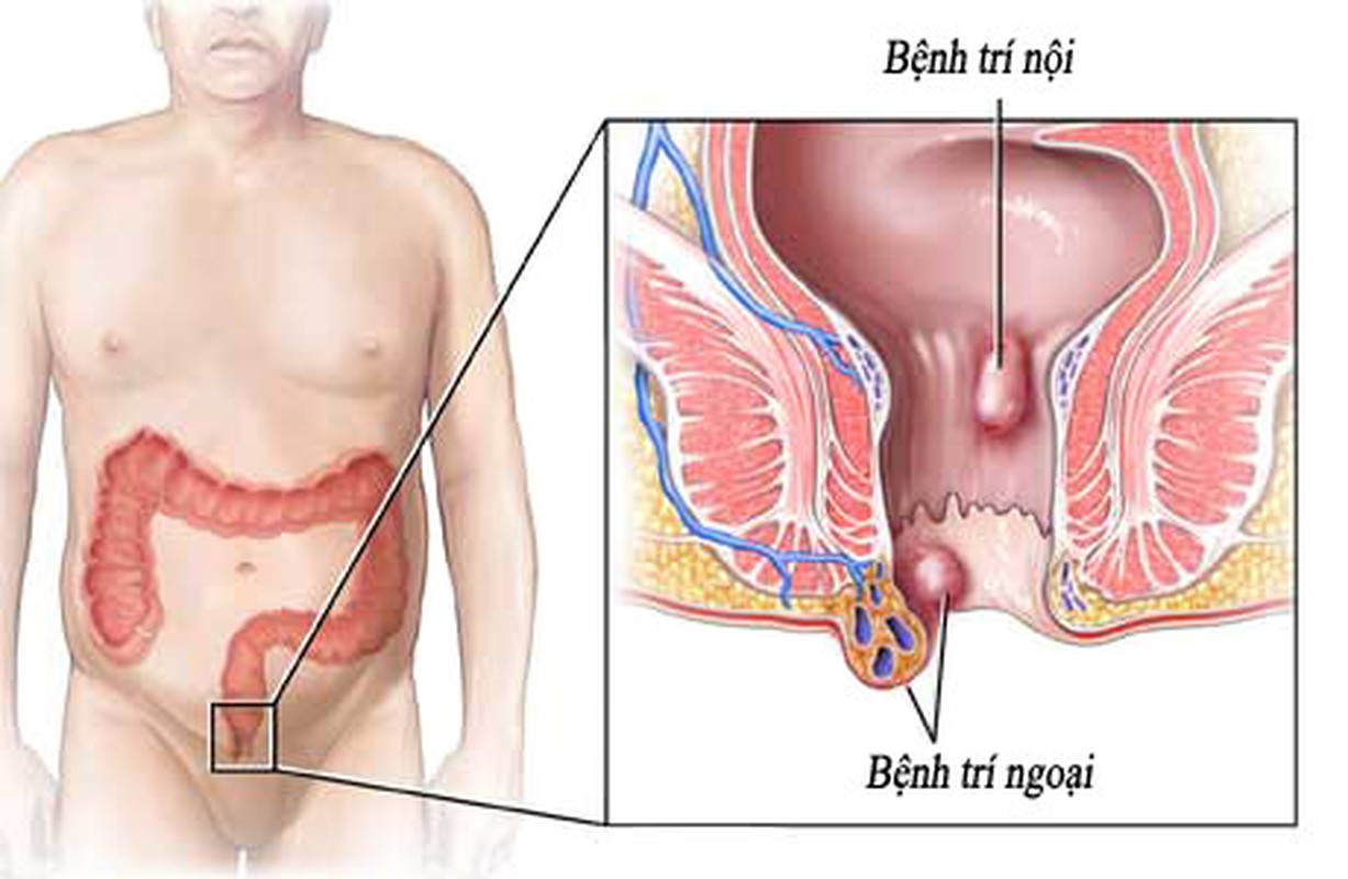 Bai thuoc bo mau tuyet voi tu nhung loai hat co mau do-Hinh-11