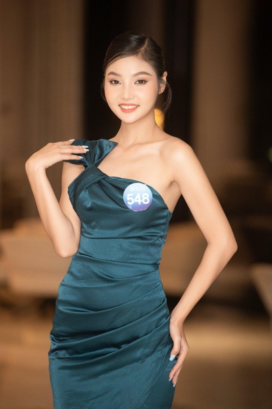 Nguoi dep ao dai noi ve vet seo tren mat-Hinh-5