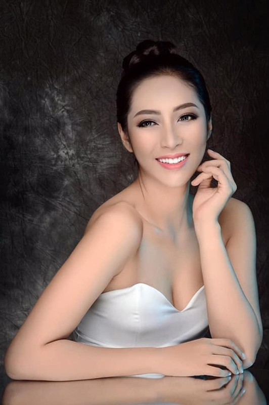 4 hoa hau phau thuat tham my: Phuong Khanh sua 9 bo phan-Hinh-2