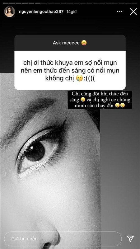 Ngoc Thao lo moi tham, da day mun sau lop make up vi dieu-Hinh-5