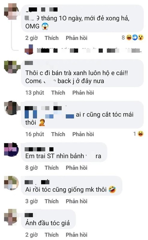 Hai Tu bi soi toc hoi, eo mo, mat nhot nhat nhu “me bim“-Hinh-4