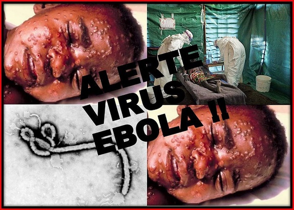 Tim hieu nhung bi mat ve noi bung phat dai dich benh Ebola