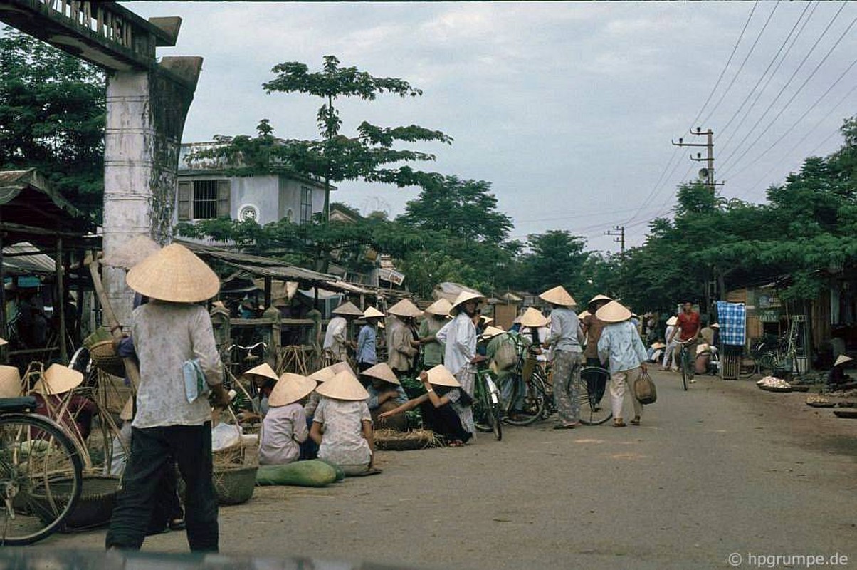 Anh khong the quen ve doi thuong o Quang Nam nam 1991, 1992-Hinh-2