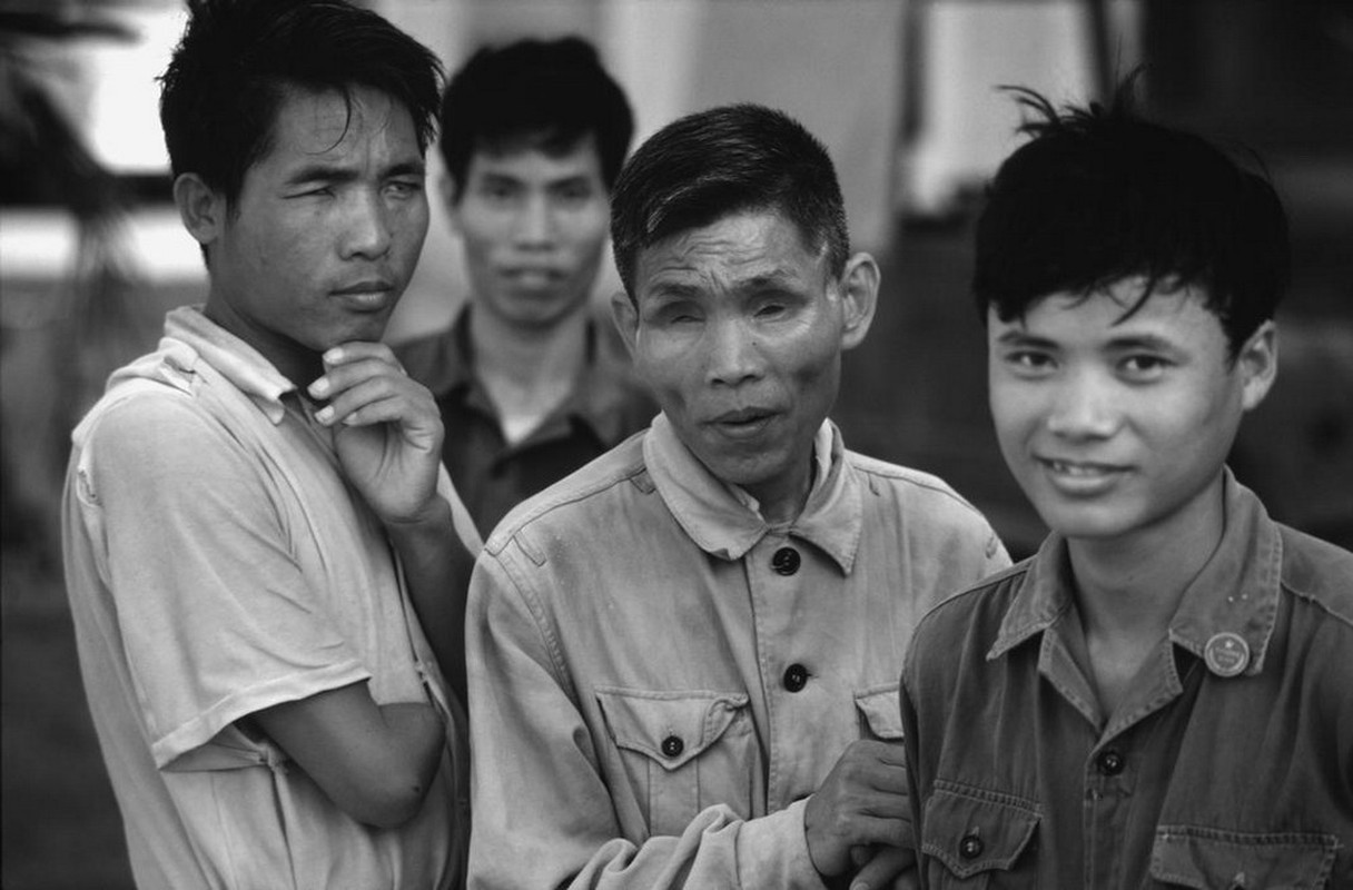 View - 	Ảnh quý về thương binh VN qua ống kính Philip Jones Griffiths