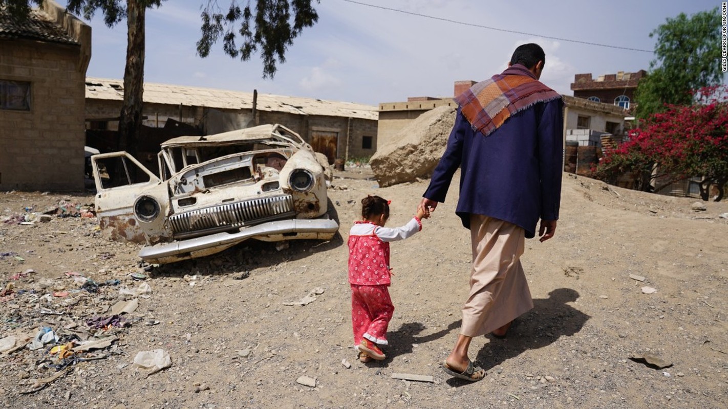 Toan canh cuoc khung hoang nhan dao tram trong o Yemen-Hinh-9