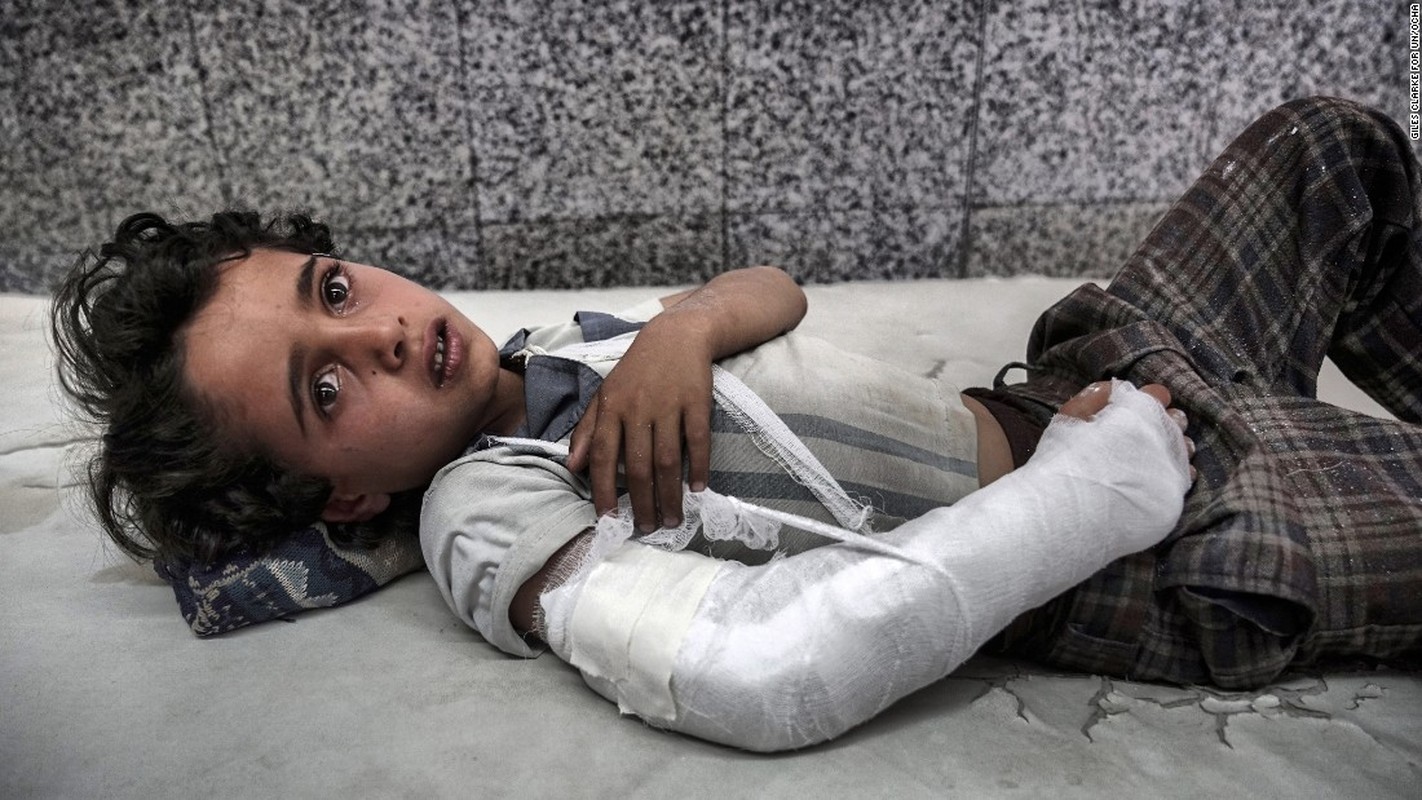 Toan canh cuoc khung hoang nhan dao tram trong o Yemen