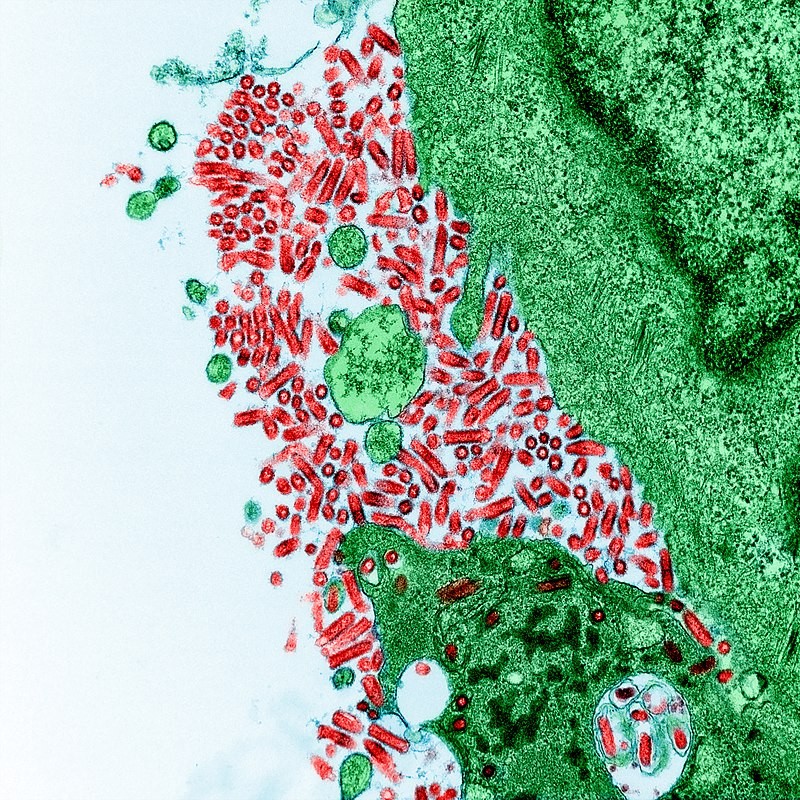 10 loai virus “chet choc” nhat lich su-Hinh-6