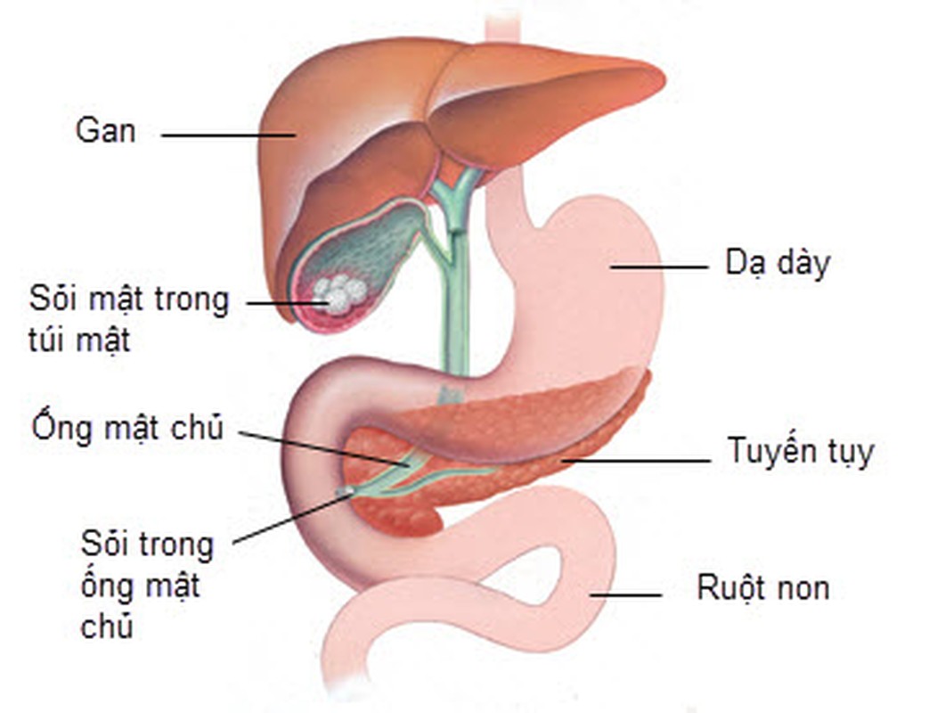 Nhung nguoi khong duoc uong nuoc gung giam can-Hinh-3