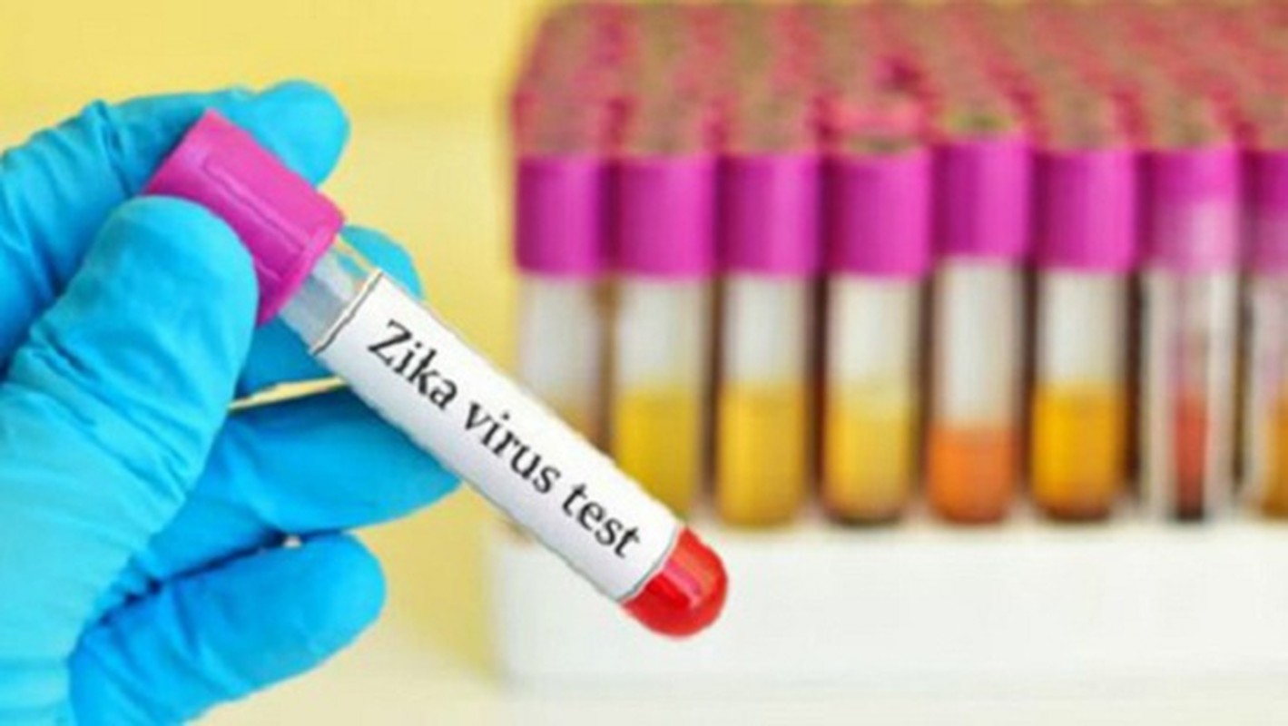 Chi tiet quy trinh xet nghiem virus Zika tai Viet Nam-Hinh-4