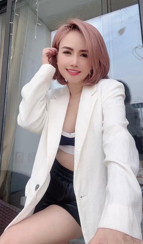 Hoang Yen ngay cang tre xinh sau vu bi chong cu bao hanh