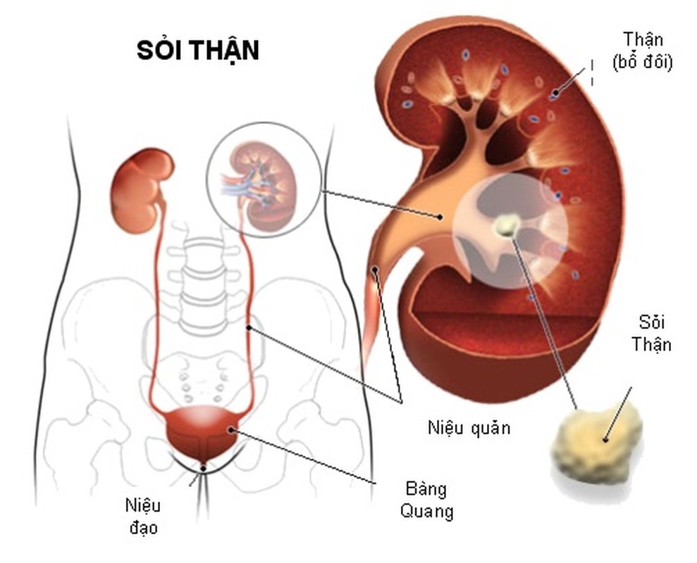 &quot;Nhan sam trang” re tien chua bach benh-Hinh-6