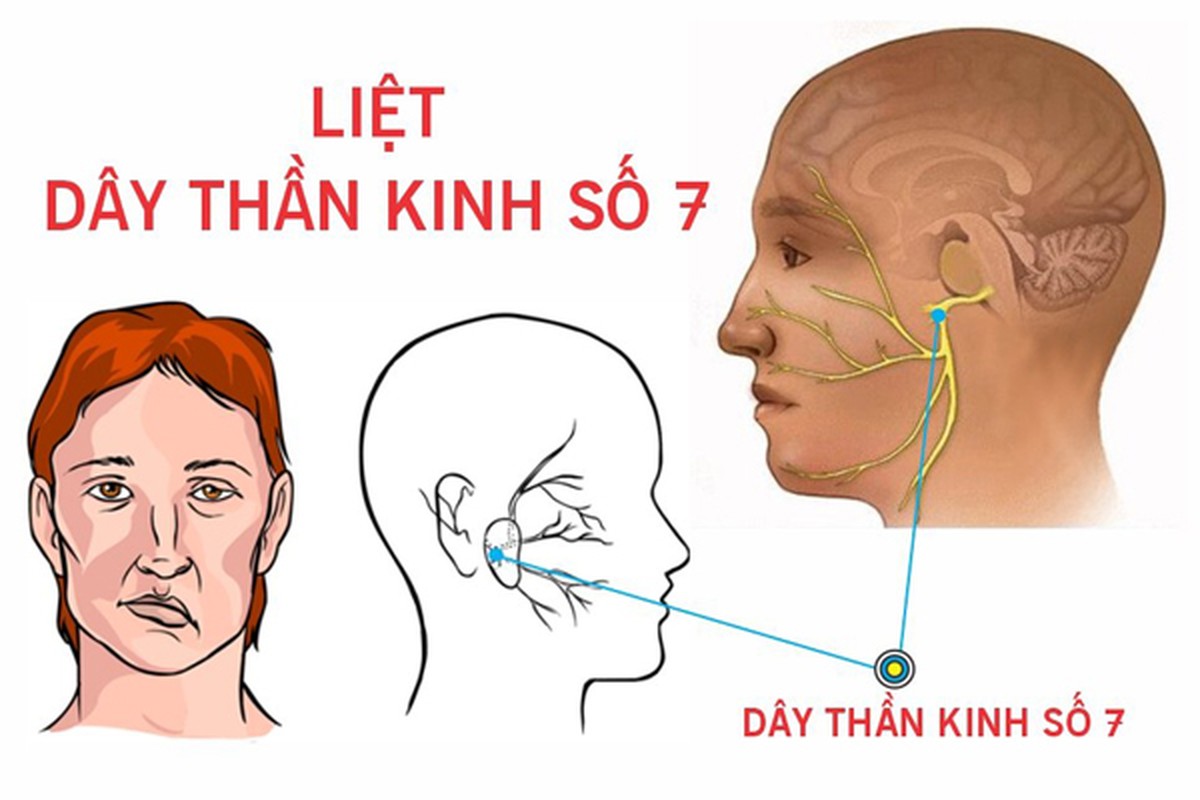 Bat dieu hoa ca dem, chang trai kho so vi guong mat bien dang-Hinh-4