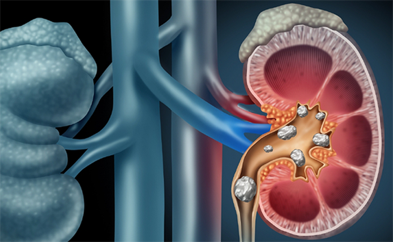 Dau nhuc that lung, co gai hai hung vi than toan soi