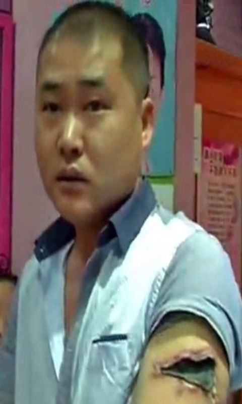 Cai ket dang cho trai tre tu xoa hinh xam de tiet kiem-Hinh-2