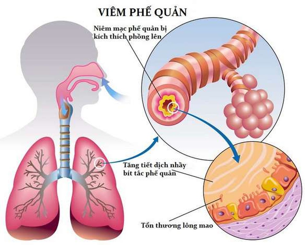 5 bai thuoc chua benh cuc tot tu vo cu cai-Hinh-6