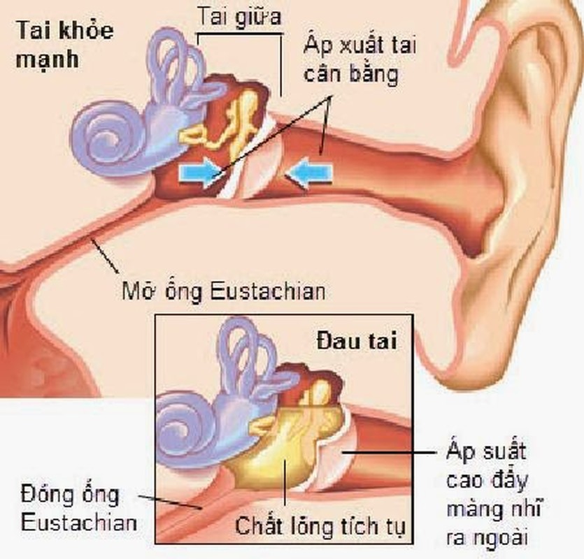 Chay mau o cac bo phan nay, dung coi thuong vi co the la benh nguy hiem-Hinh-17