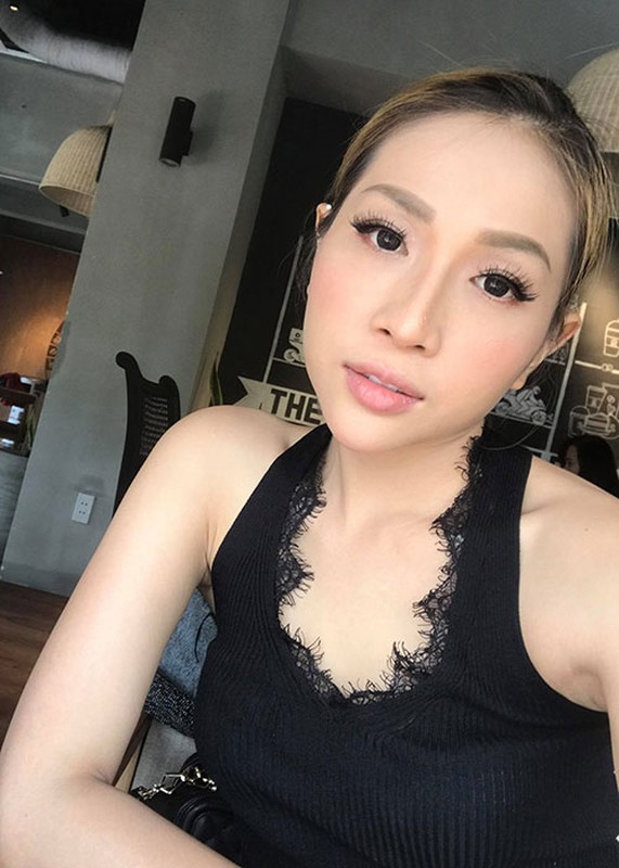 Nu dien vien Viet bi bong mat do phun lua tap kich la ai?-Hinh-5