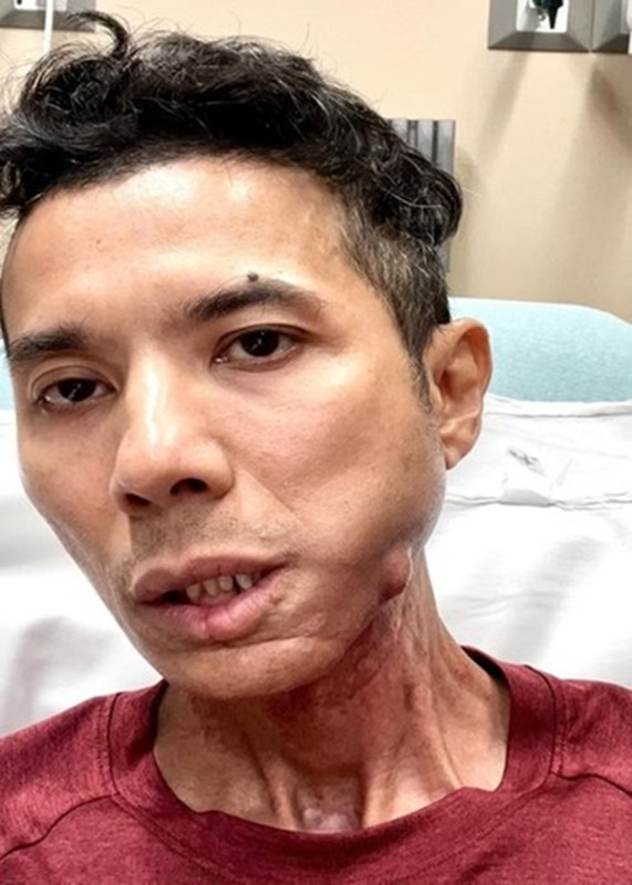 Kasim Hoang Vu was hospitalized after suffering a headache during the night - Photo 4