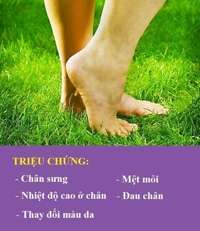 Chan sung, dau - dau hieu canh bao benh nguy hiem-Hinh-4