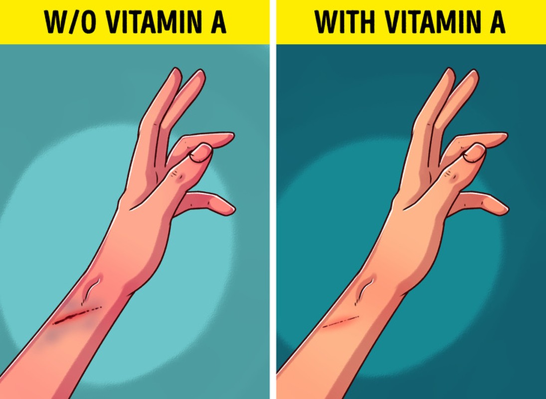 View - 	7 dấu hiệu cảnh báo cơ thể thiếu vitamin A cần chú ý ở trẻ