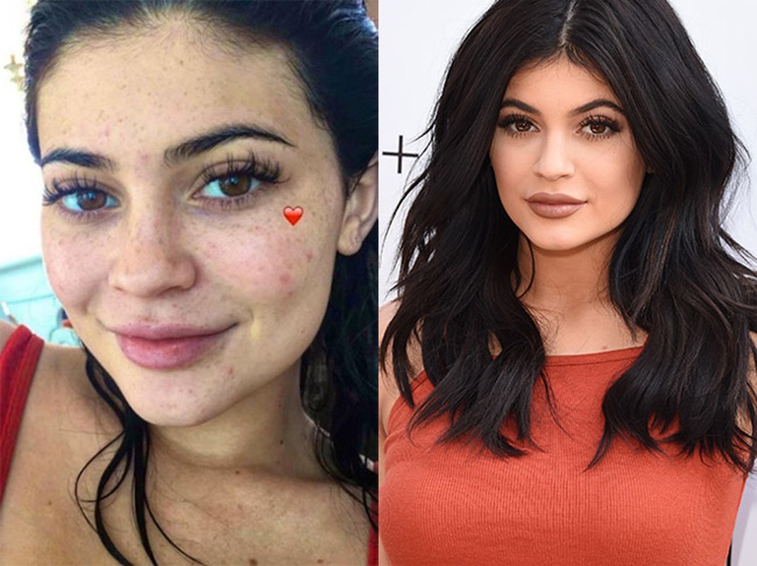 Mau tre Kylie Jenner lo anh mat moc day tan nhang-Hinh-3