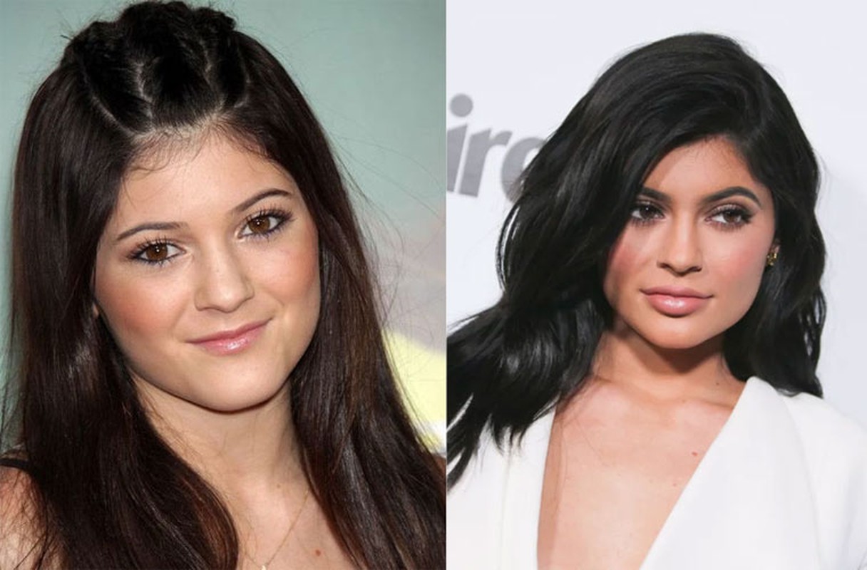 Mau tre Kylie Jenner lo anh mat moc day tan nhang-Hinh-5