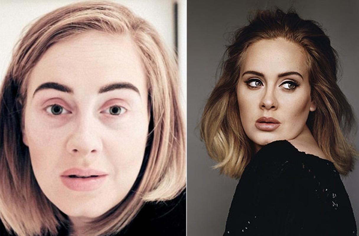 Adele lo mat moc xau xi khien fan te ngua-Hinh-3