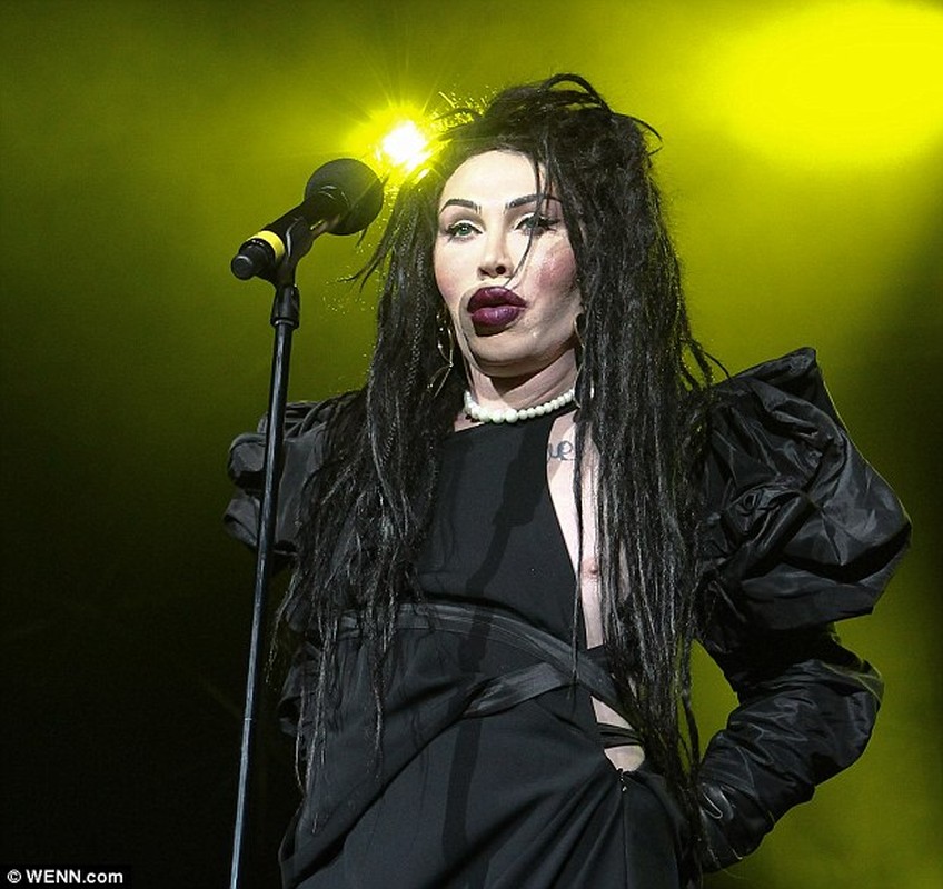 Pete Burns thay doi the nao sau 300 lan phau thuat tham my-Hinh-14