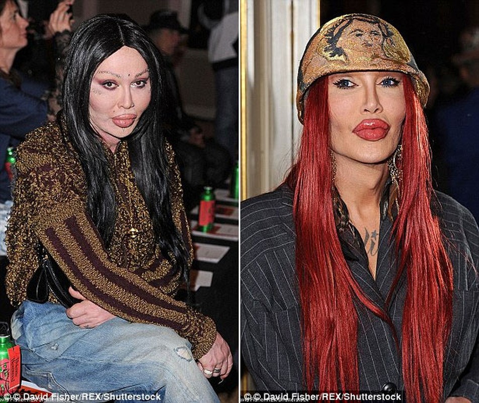 Pete Burns thay doi the nao sau 300 lan phau thuat tham my-Hinh-6