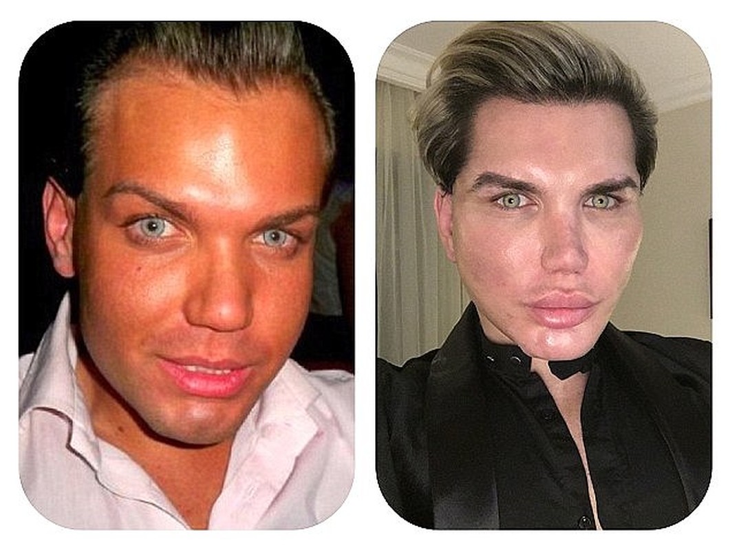 Rodrigo Alves pha nat mat vi muon lam bup be song Ken-Hinh-4