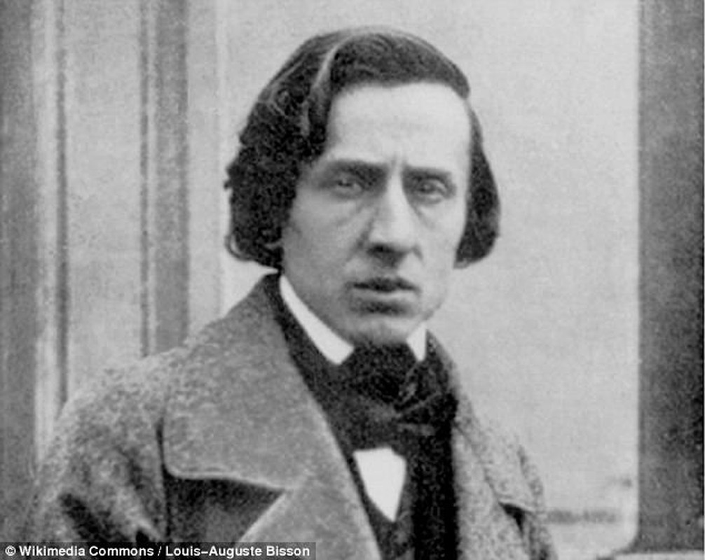 Giai ma cai chet bi an cua nha soan nhac Frederic Chopin-Hinh-7