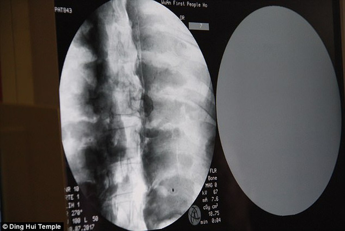 Chup X-quang, lo bi mat “khung” xac uop nha su hon 1.000 tuoi-Hinh-3