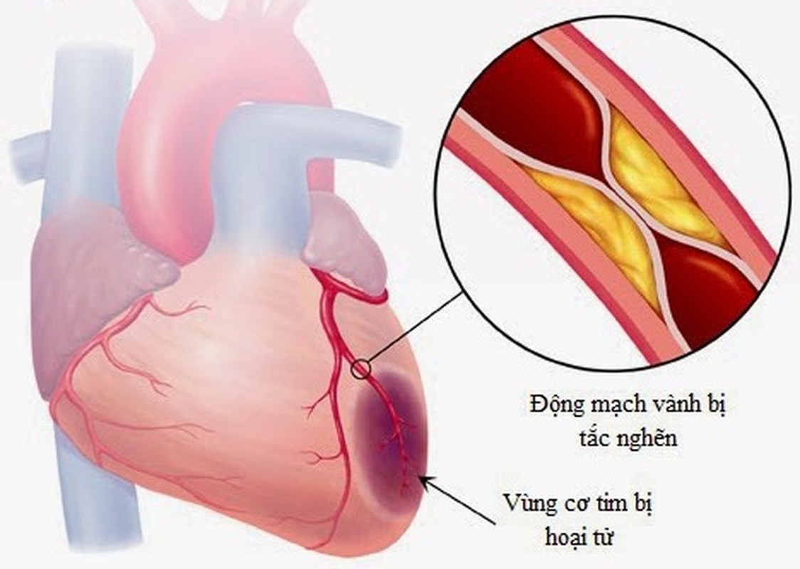 Ly giai tai bien khien nhac si An Thuyen qua doi-Hinh-13