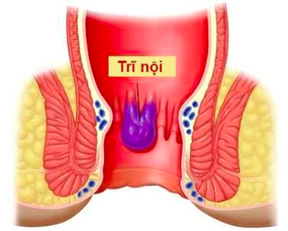 Bai thuoc chua nhiem trung bang rau coc cuc hieu qua-Hinh-6