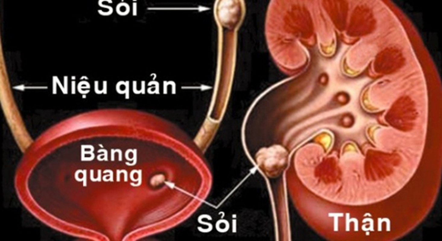 Thay dỏi kinh ngạc của co thẻ sau 1 tuàn uóng nuóc dùa-Hinh-3