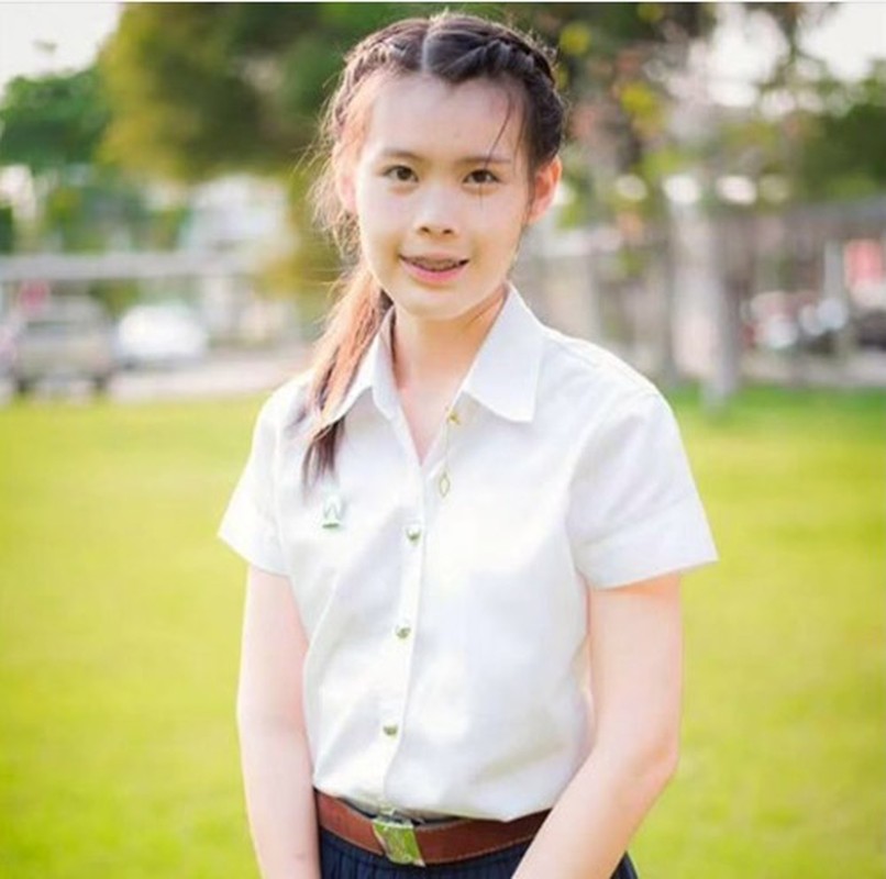 Anh truoc va sau dang kinh ngac cua thieu nu mat lech-Hinh-9