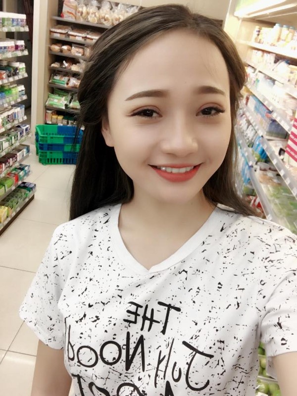 Khoe anh sau phau thuat tham my, 9X bi vu oan lam 