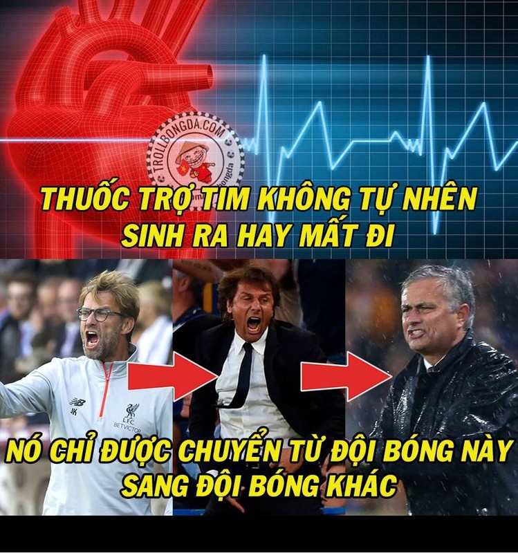 Anh che bong da: HLV Ngoai hang Anh mua thuoc tro tim-Hinh-6