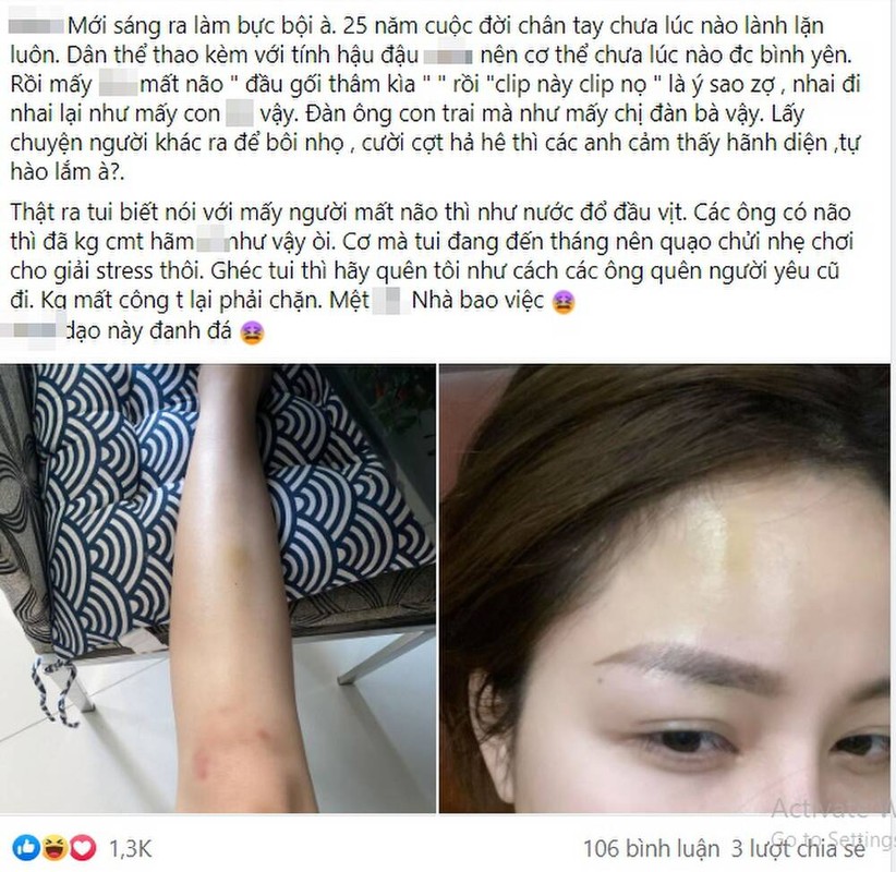 Dang anh dau goi tham, Tram Anh bi anti-fan buong loi khiem nha-Hinh-4