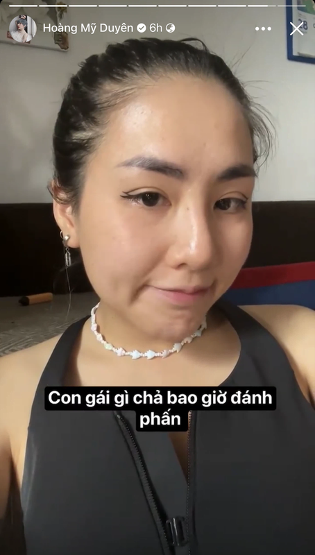 Lo anh cam thuong, ban gai cu Dat G khien netizen thac mac vong 1-Hinh-4