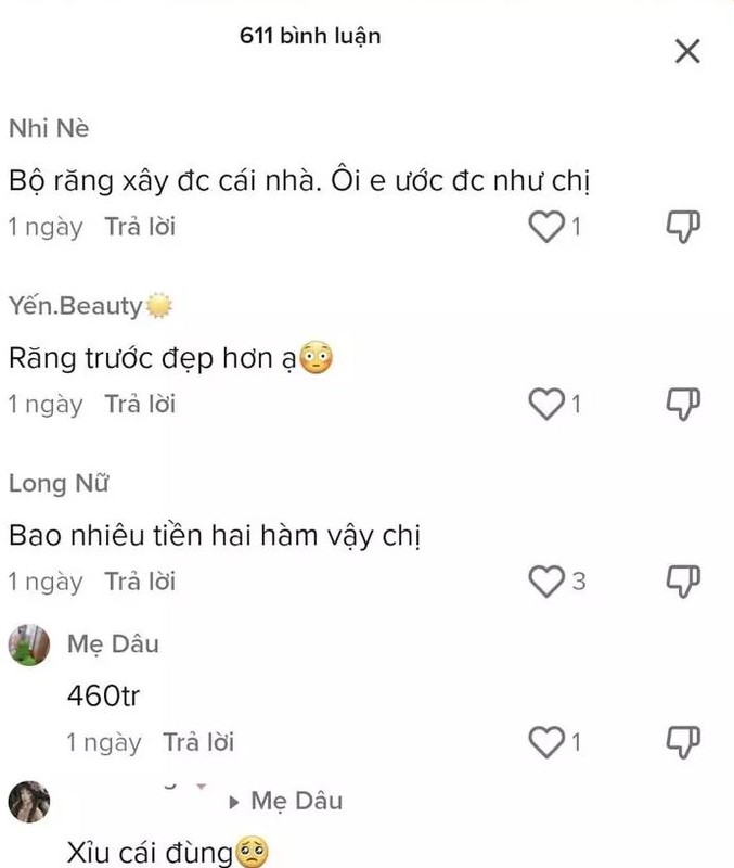 Khoe lam rang gan nua ty, Trang Nemo duoc khuyen nen lam dieu nay-Hinh-4