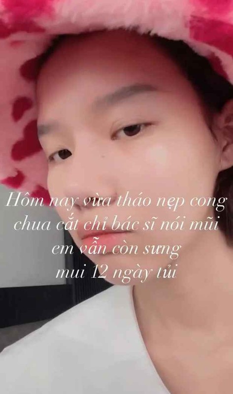 Di sua mui gia 300 trieu, TikToker Dong Thap 