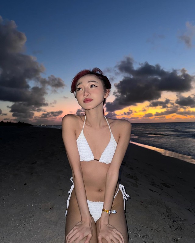 Sau tham my vong mot, Tiktoker Clara Dao tich cuc khoe hinh anh moi-Hinh-7