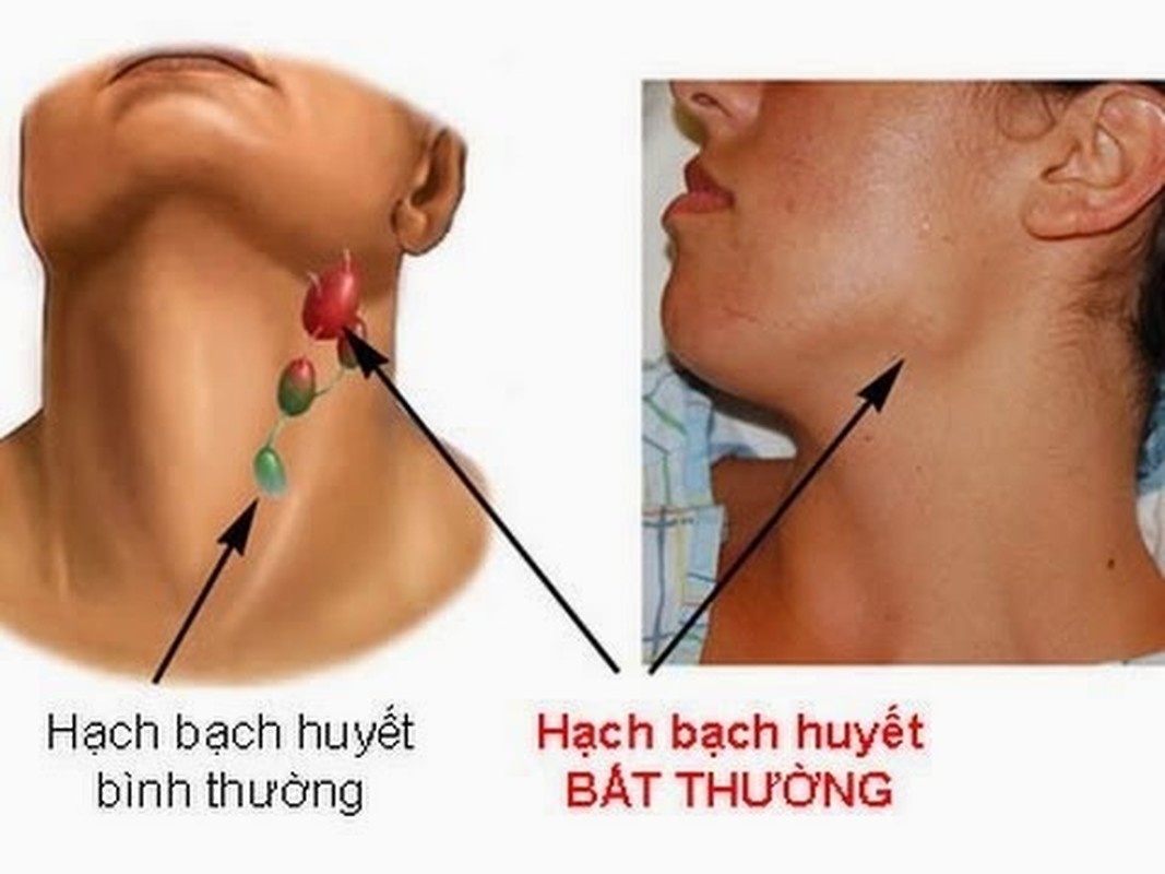 Hut thuoc la co the lam hong ADN vinh vien-Hinh-5