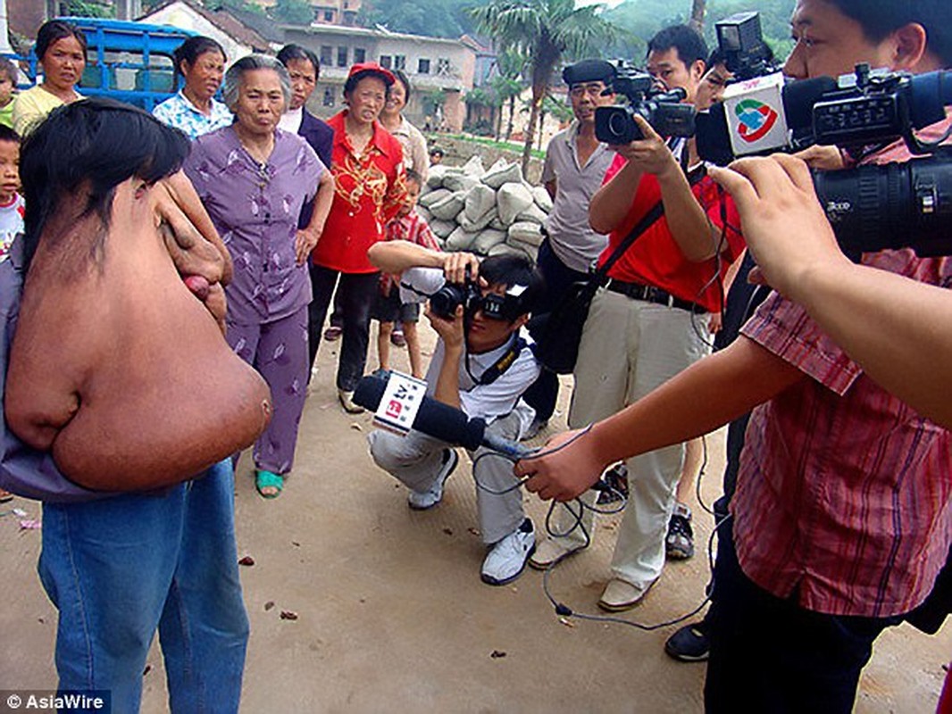 Mat bien dang nhu quai vat vi u nang 12kg-Hinh-3