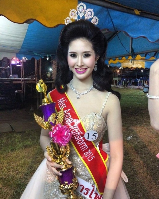 Soi nhan sac truoc phau thuat cua Tan Hoa hau Chuyen gioi Thai-Hinh-5