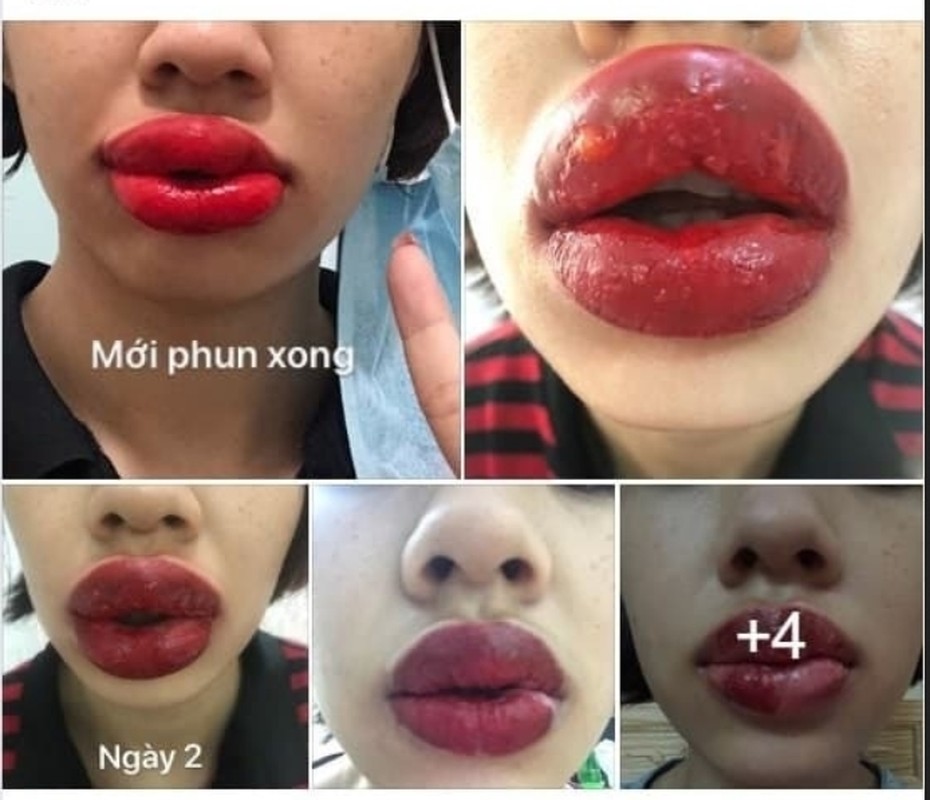 “Sang chan tam ly” voi tham hoa phun xam moi lam netizen am anh-Hinh-4