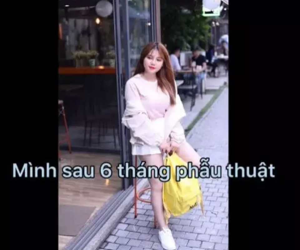 “Hot girl nguc khung” lo ly do hut mo nhung nguc van y nguyen-Hinh-6