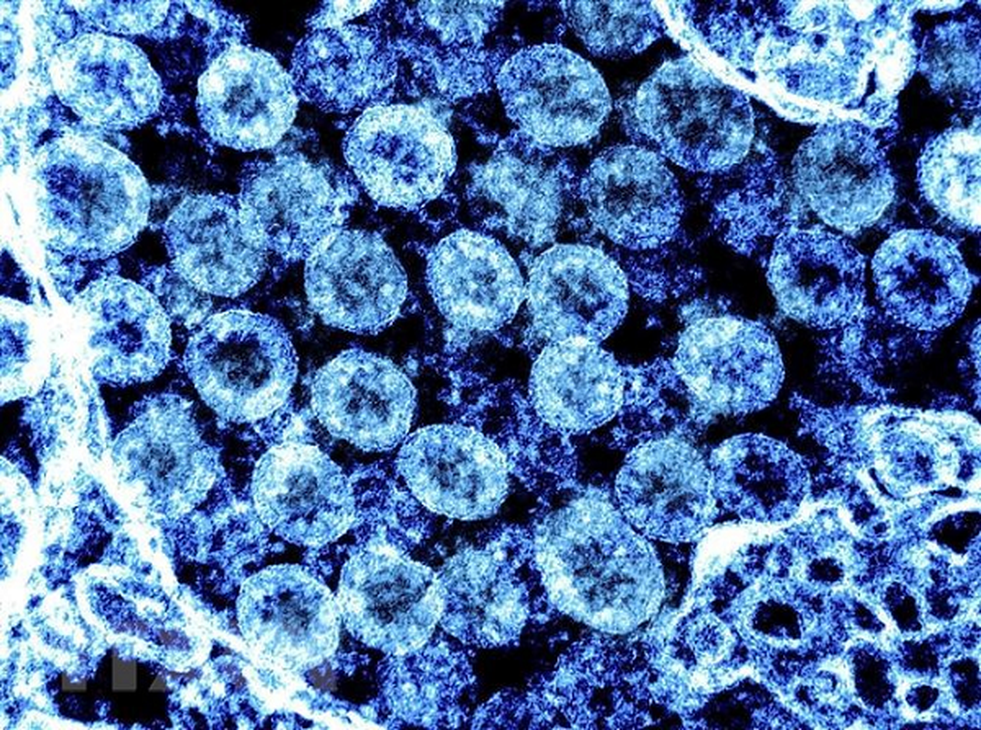 CDC Trung Quoc canh bao: Virus SARS-CoV-2 dang lan rong kho kiem soat!-Hinh-12