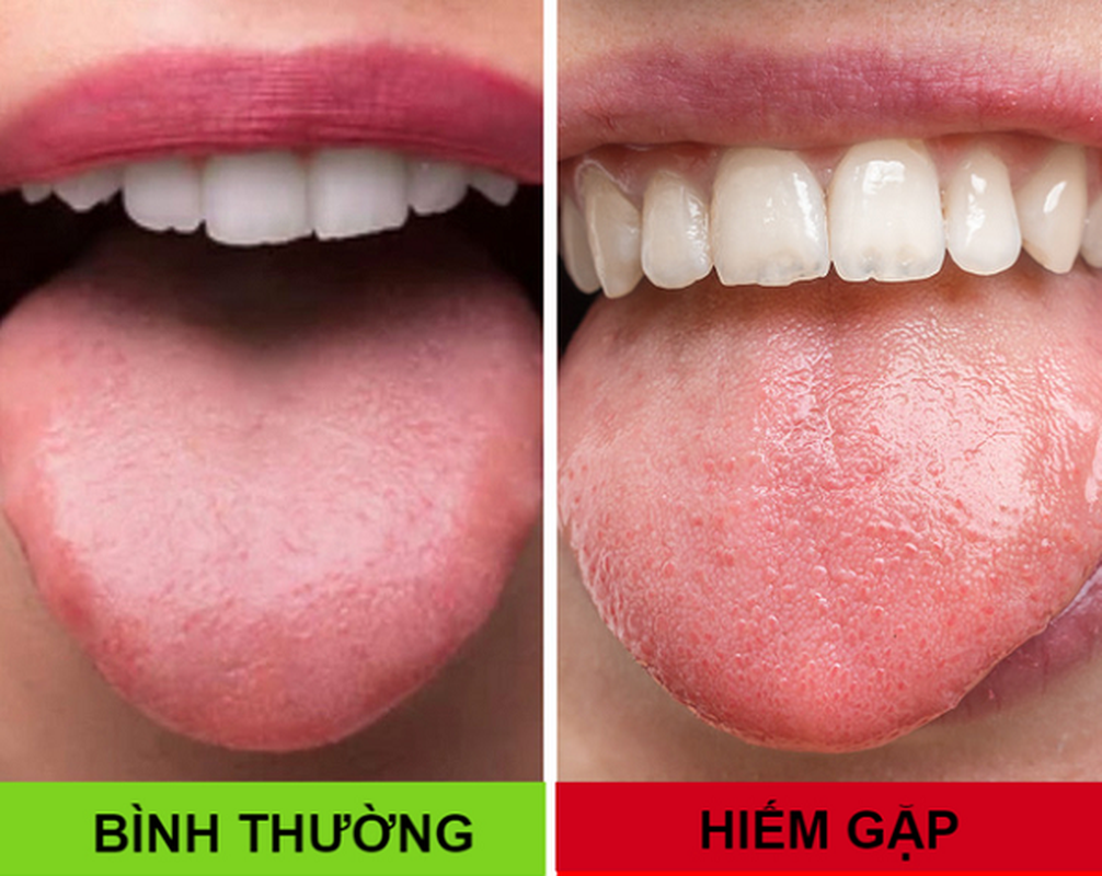 Co nhung dac diem nay, ban chac chan thuoc nhom dac biet nhat the gioi!-Hinh-7